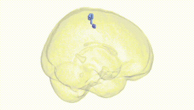 Full Brain White