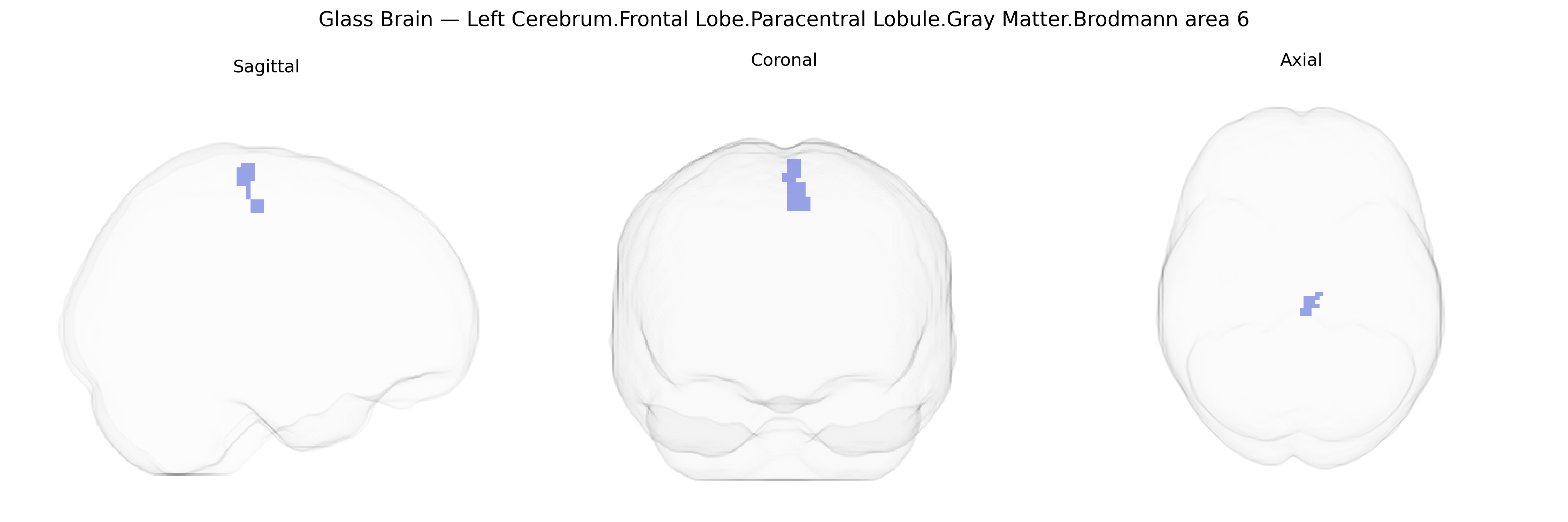 Triplanar Ghost Brain