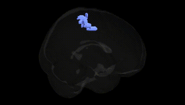 Full Brain Black