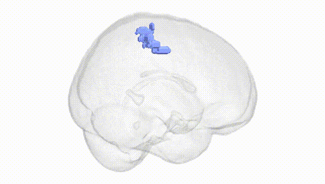 Full Brain White
