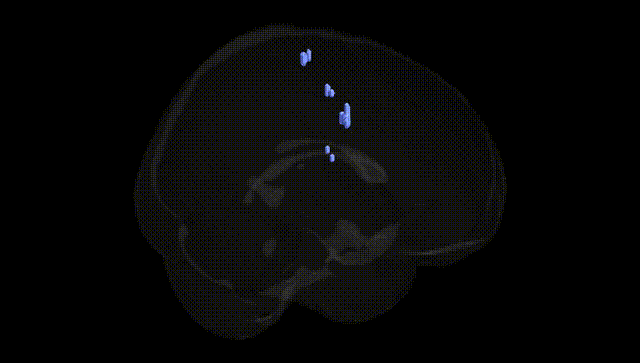 Full Brain Black