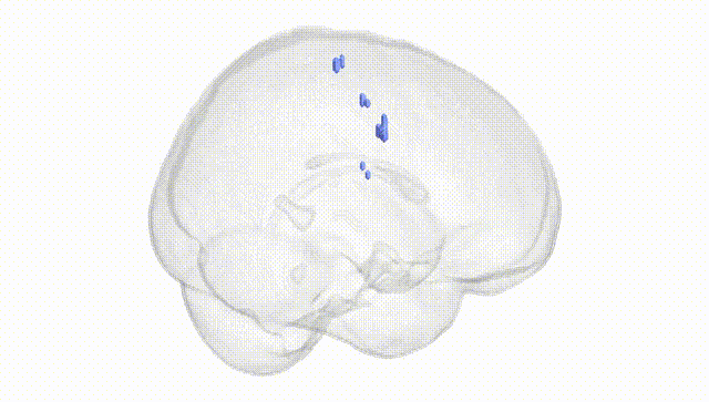 Full Brain White