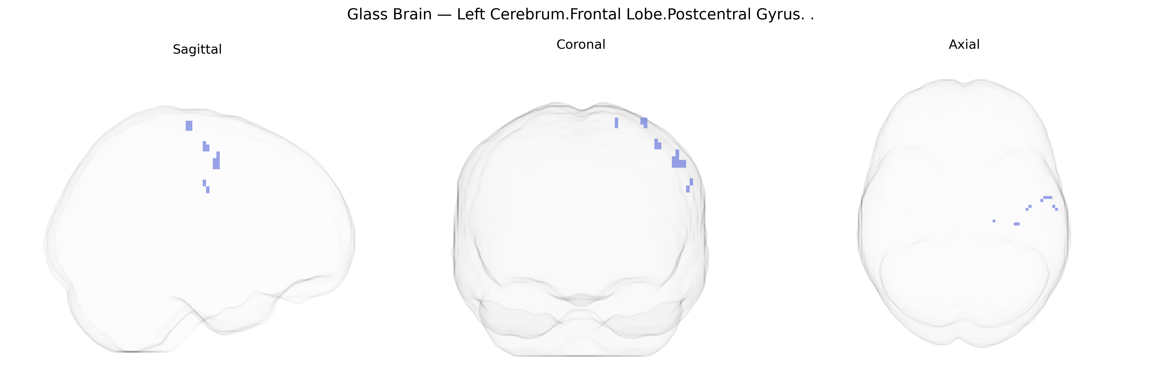 Triplanar Ghost Brain