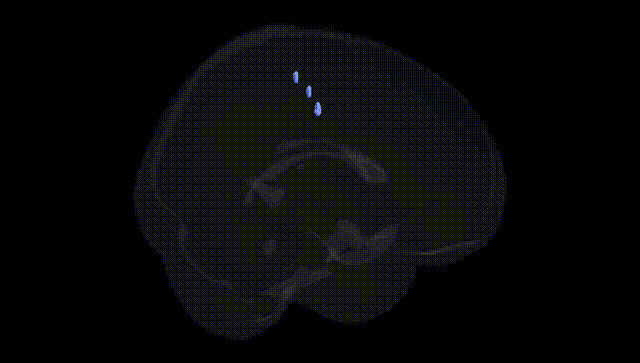 Full Brain Black