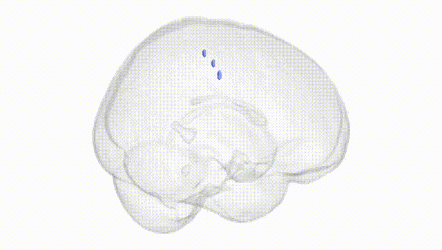 Full Brain White