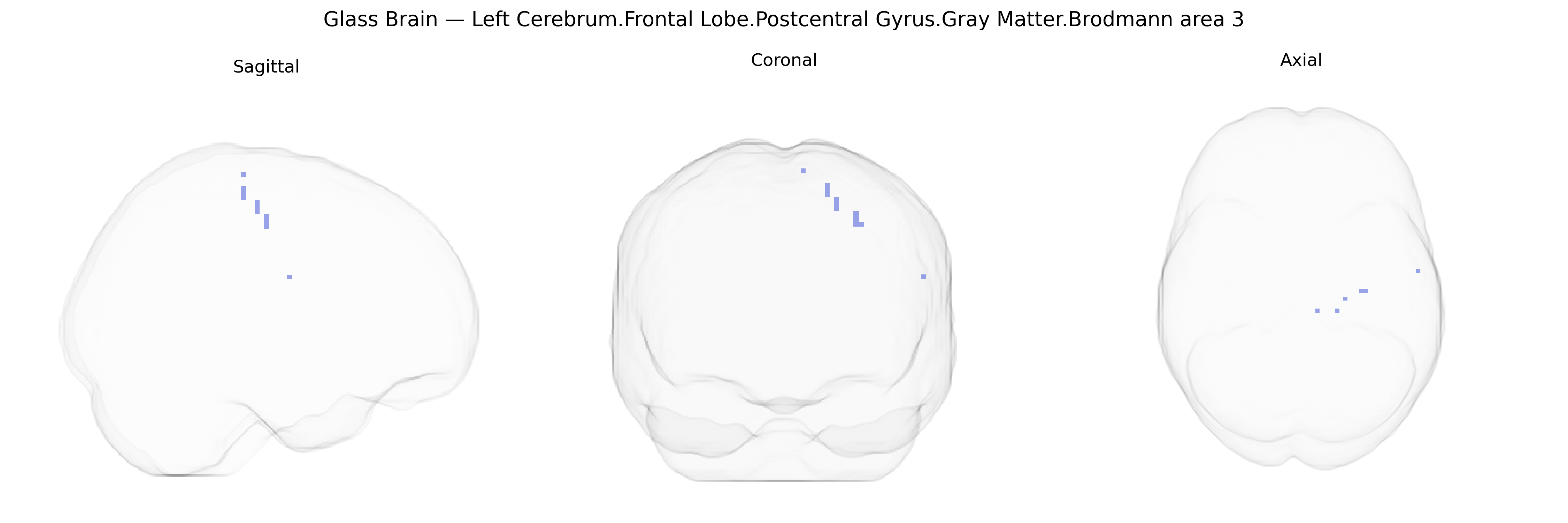 Triplanar Ghost Brain