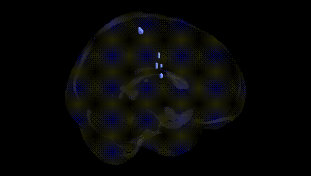 Full Brain Black