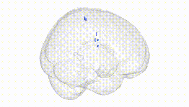 Full Brain White