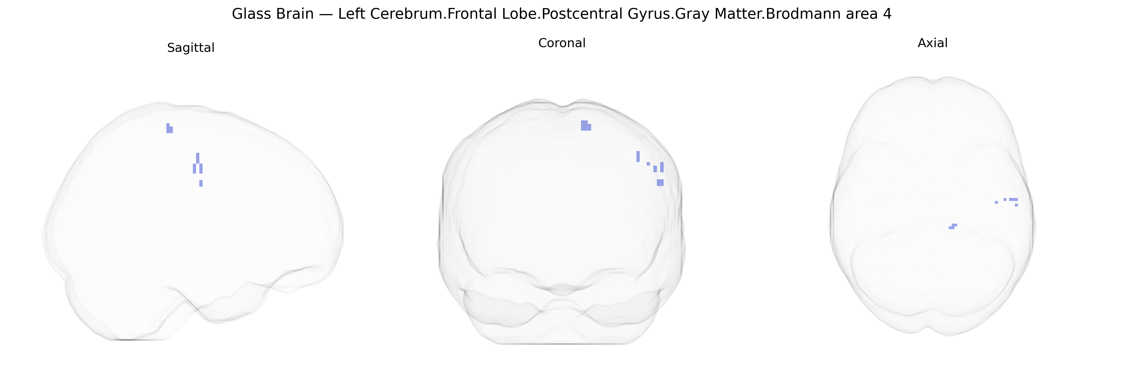 Triplanar Ghost Brain