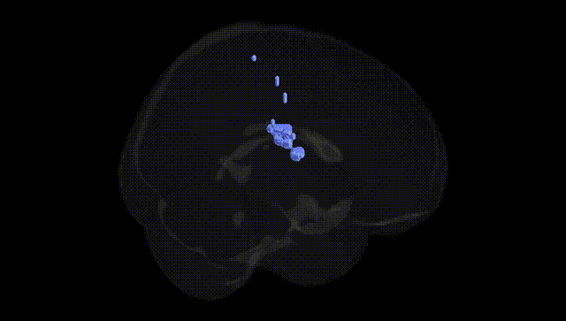 Full Brain Black