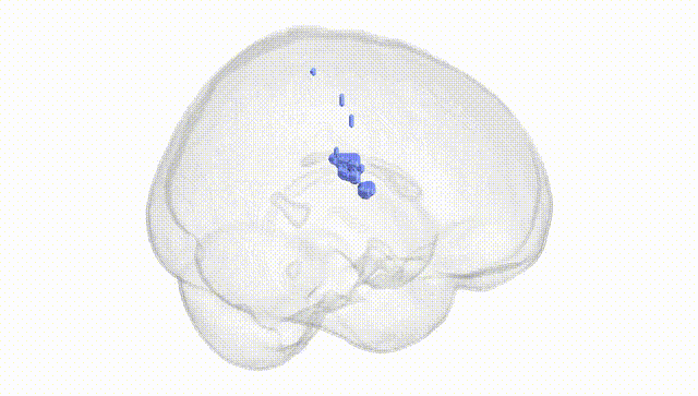 Full Brain White