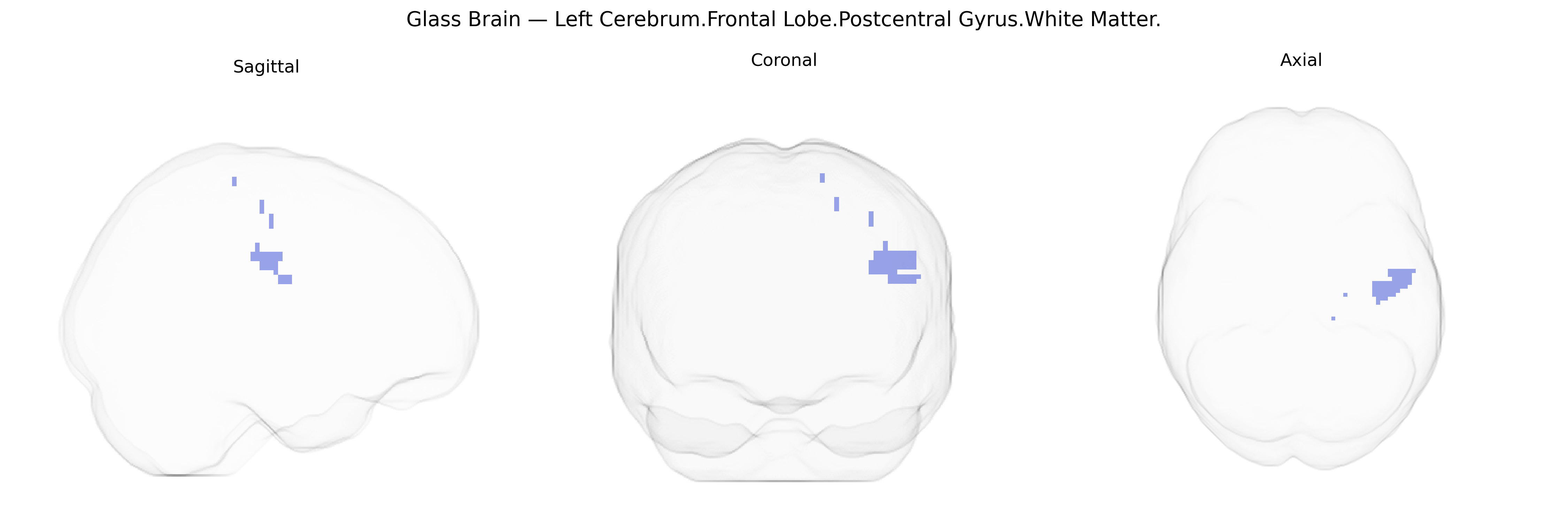 Triplanar Ghost Brain