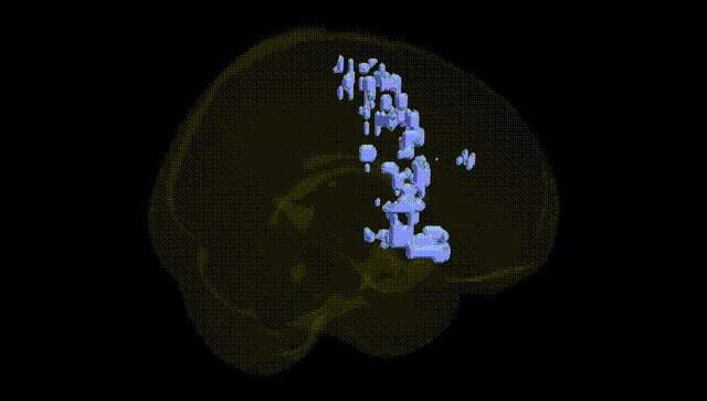 Full Brain Black