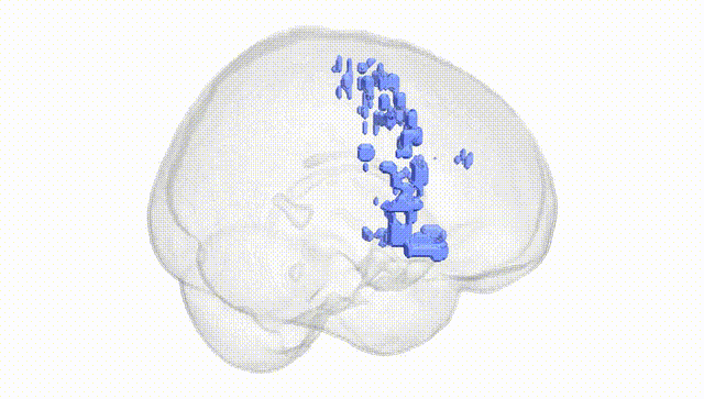 Full Brain White