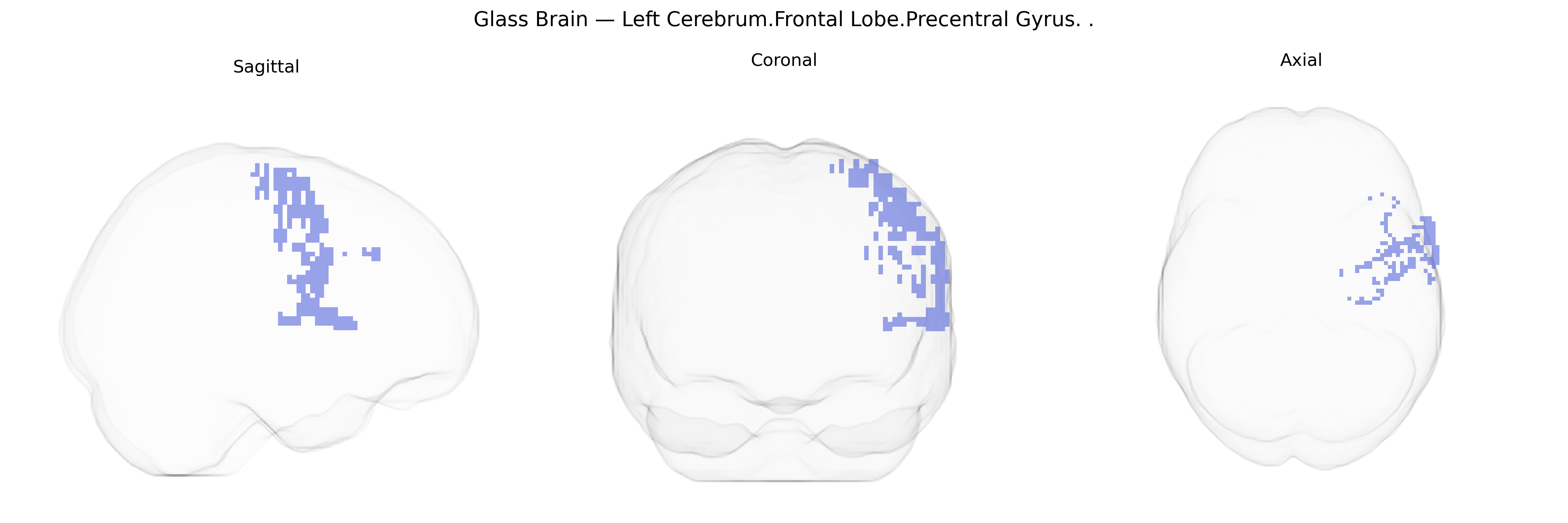 Triplanar Ghost Brain