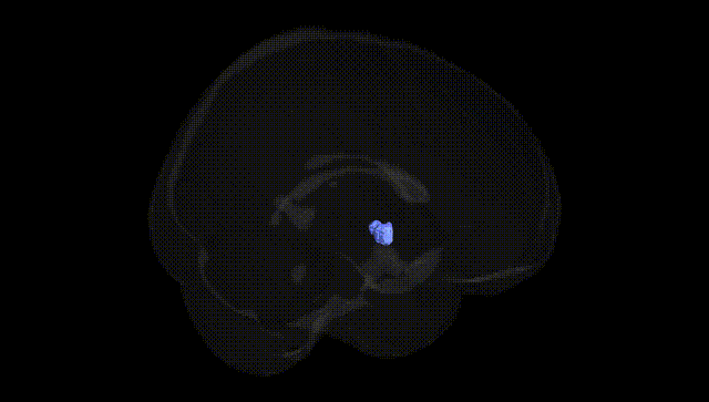 Full Brain Black