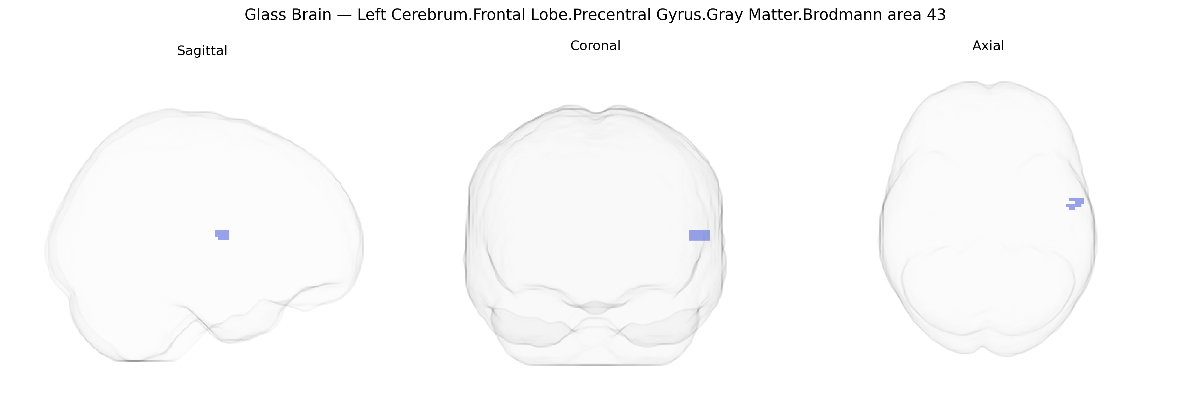 Triplanar Ghost Brain
