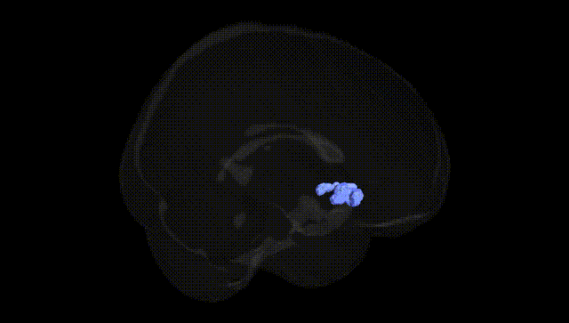 Full Brain Black