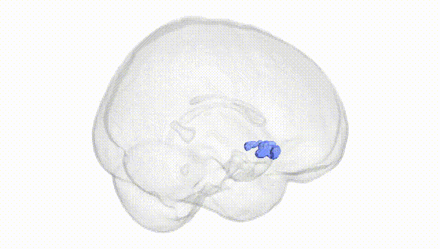 Full Brain White