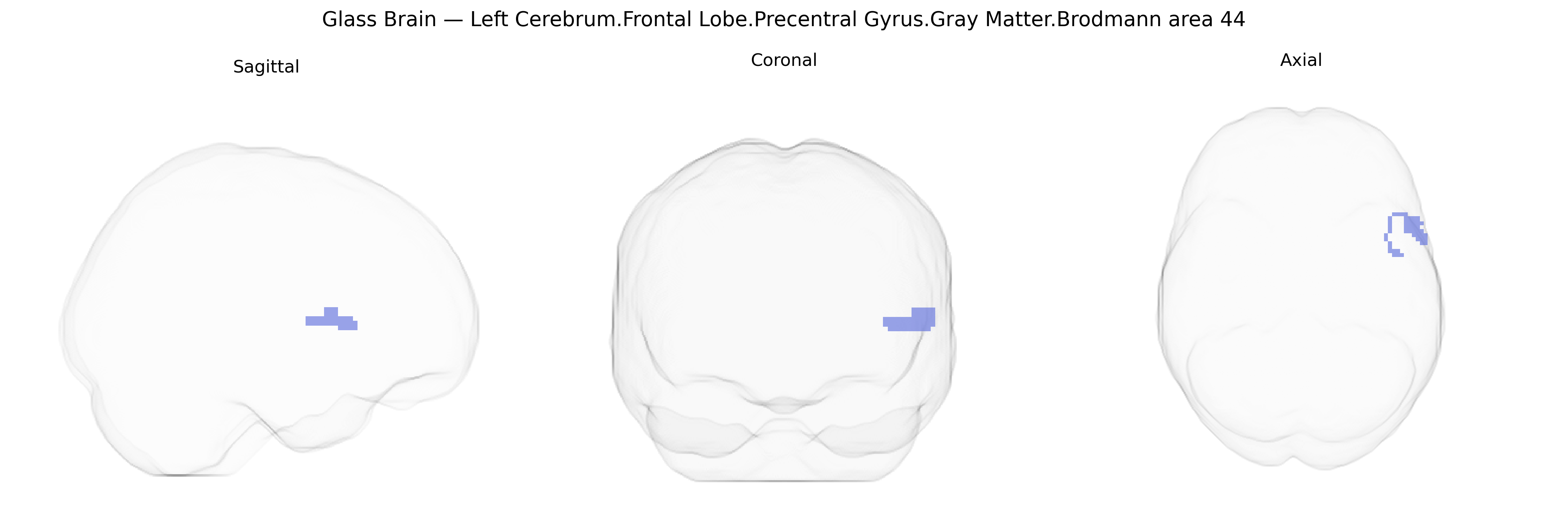 Triplanar Ghost Brain