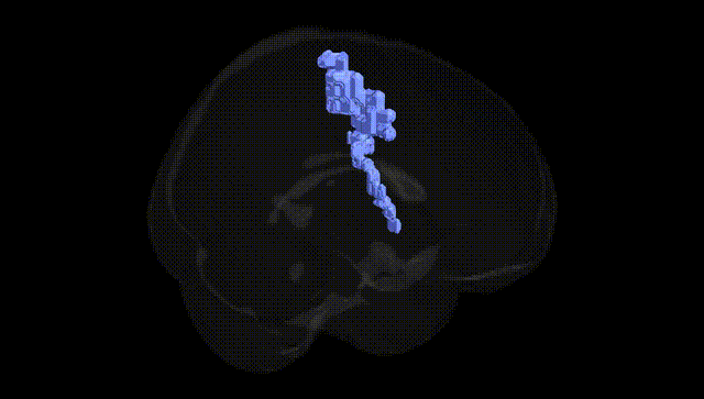 Full Brain Black
