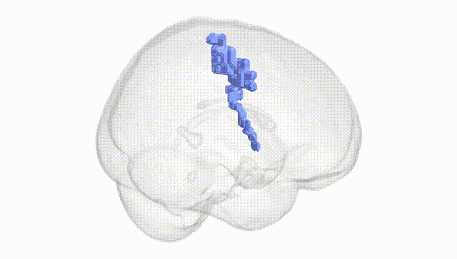 Full Brain White