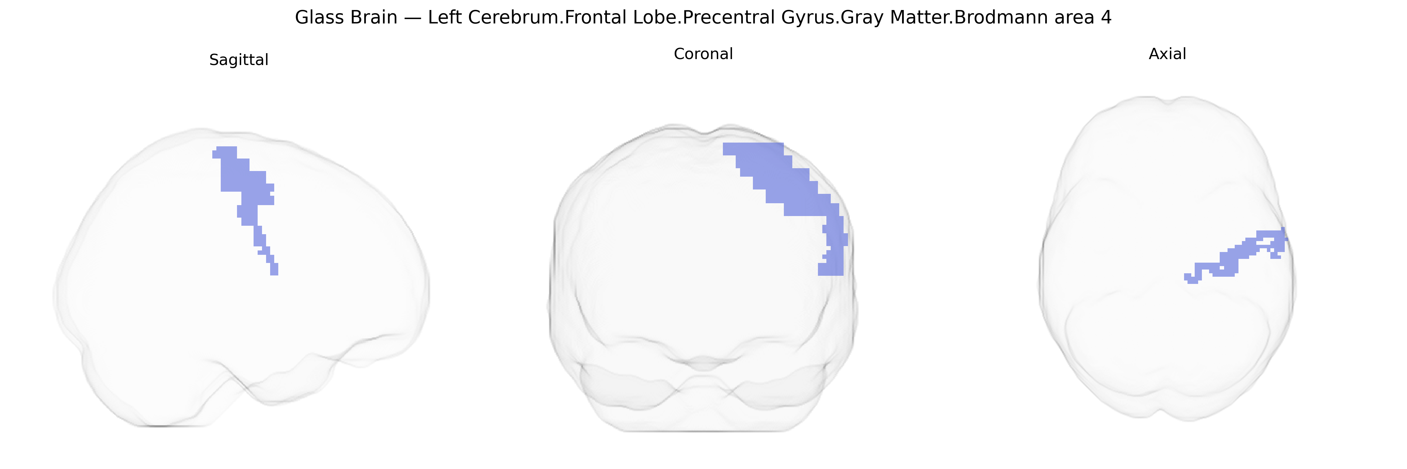 Triplanar Ghost Brain