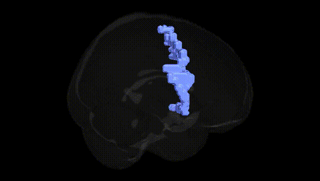 Full Brain Black