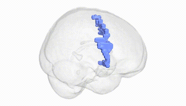 Full Brain White