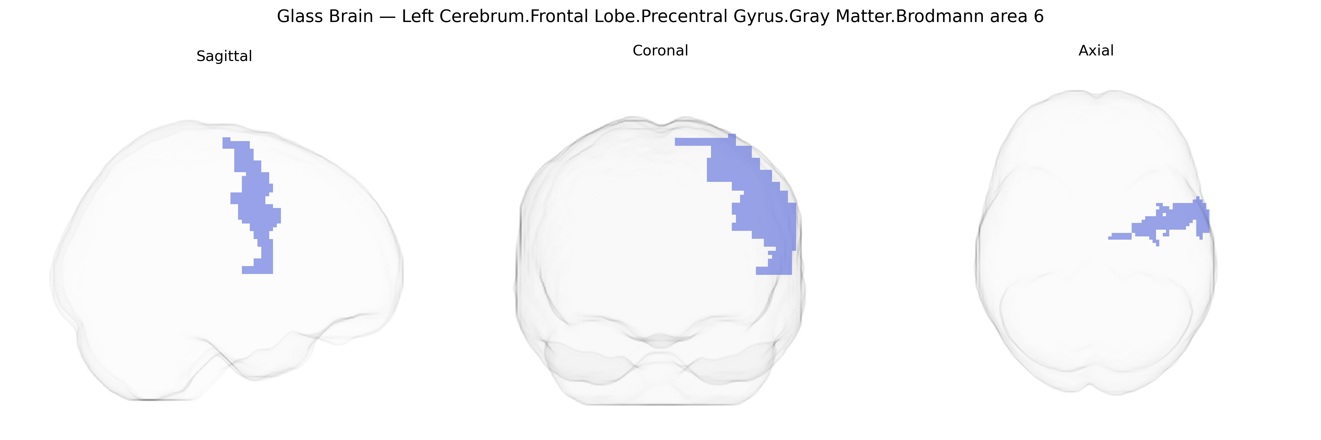 Triplanar Ghost Brain