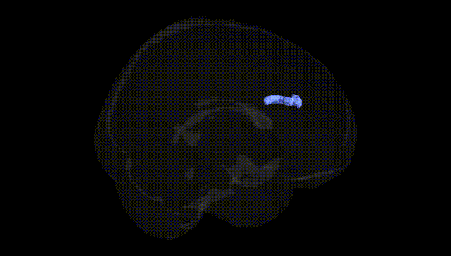 Full Brain Black