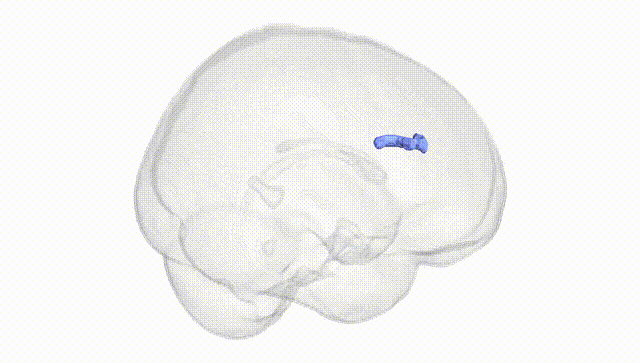 Full Brain White