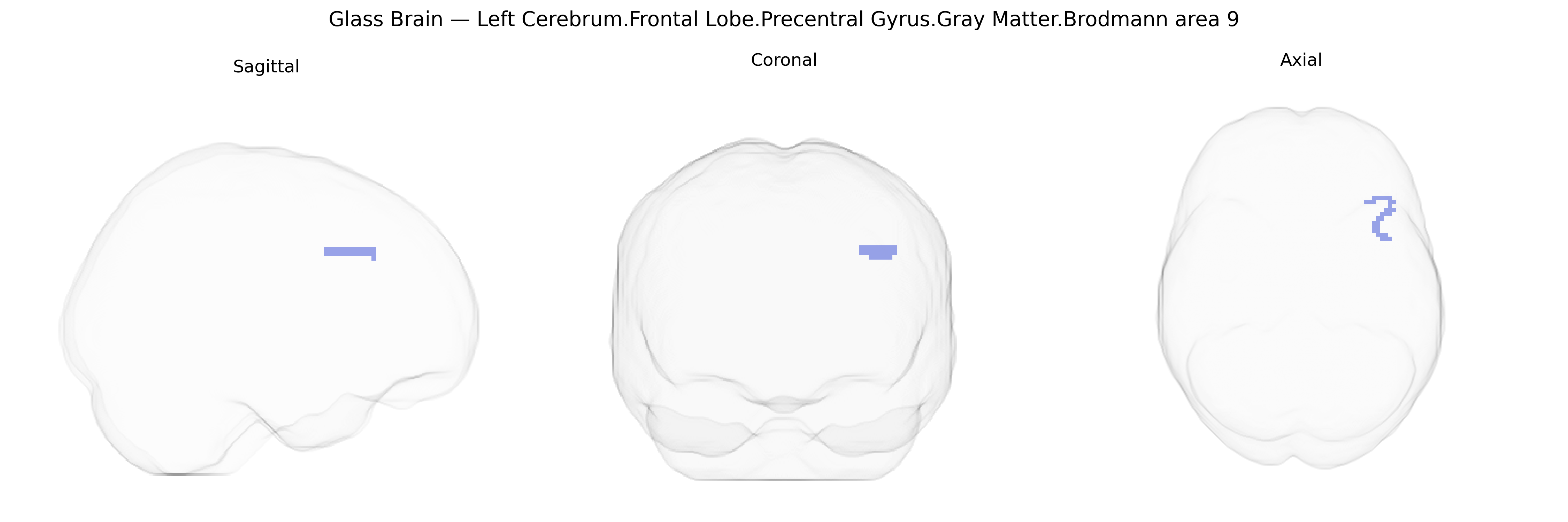 Triplanar Ghost Brain
