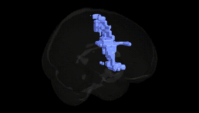 Full Brain Black