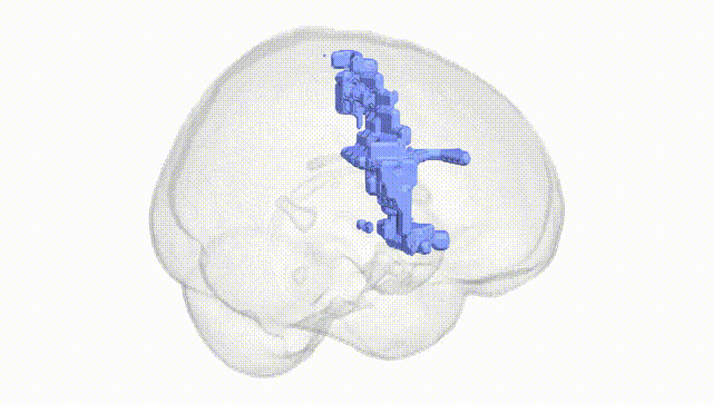 Full Brain White