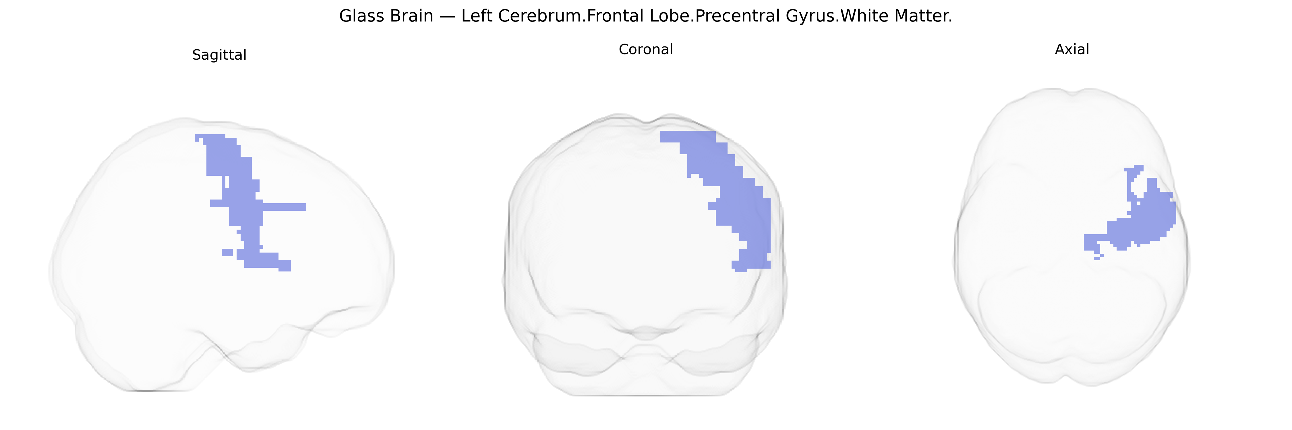 Triplanar Ghost Brain