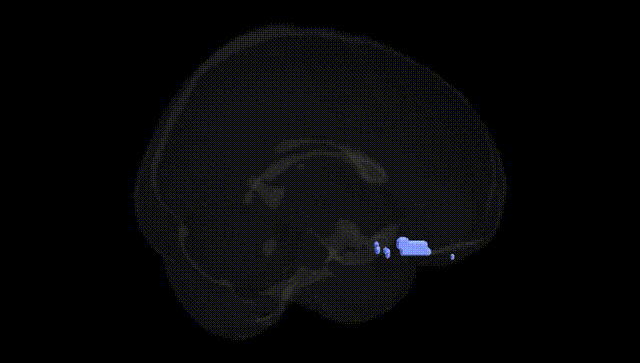 Full Brain Black