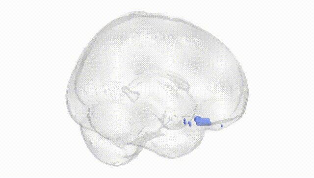 Full Brain White