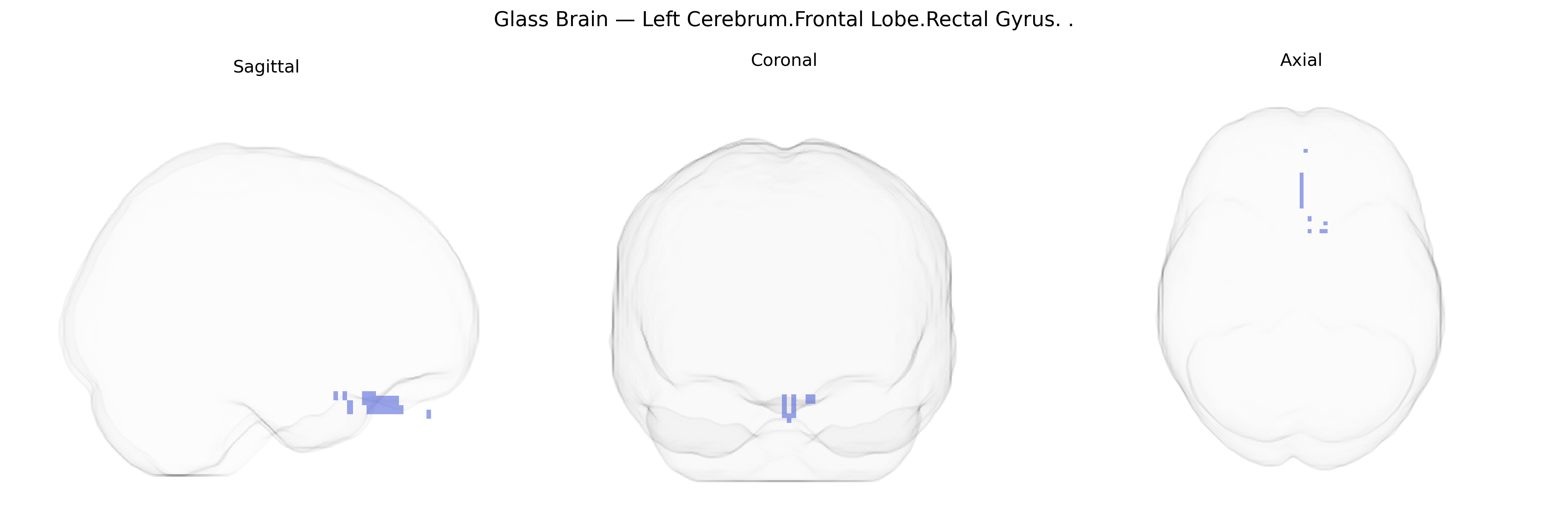 Triplanar Ghost Brain