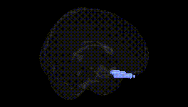 Full Brain Black