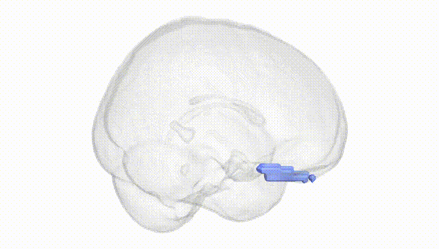 Full Brain White