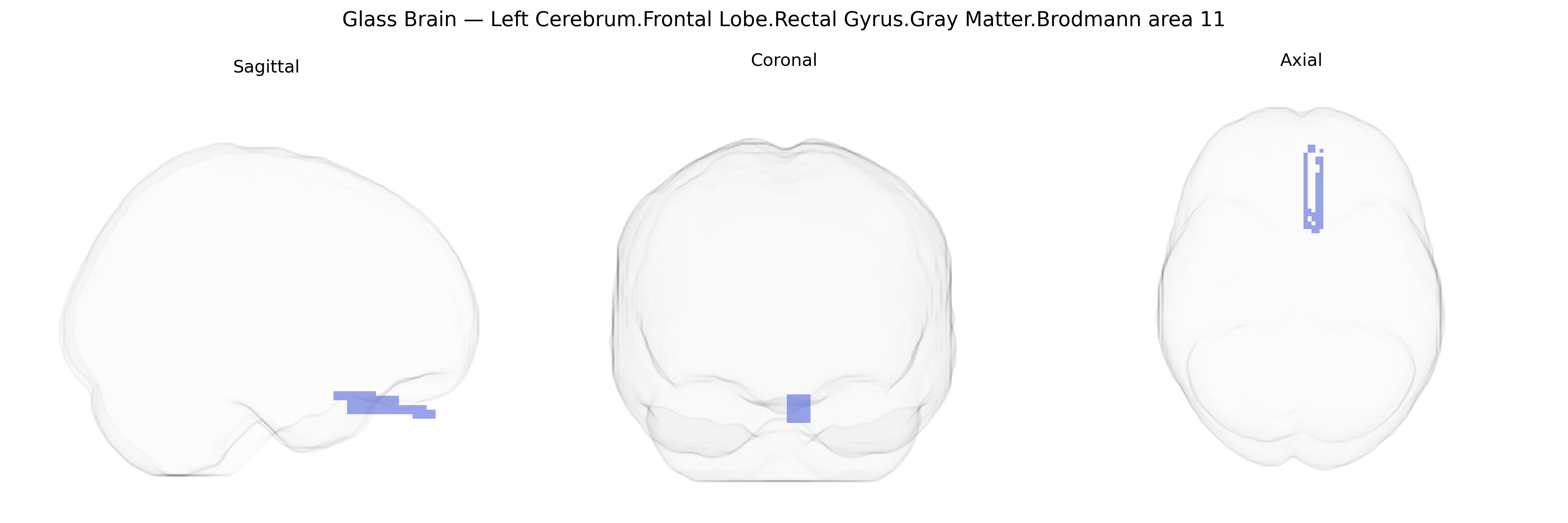 Triplanar Ghost Brain