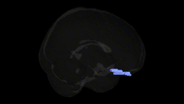 Full Brain Black