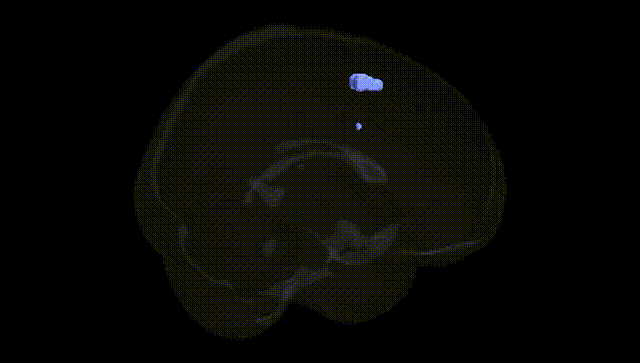 Full Brain Black