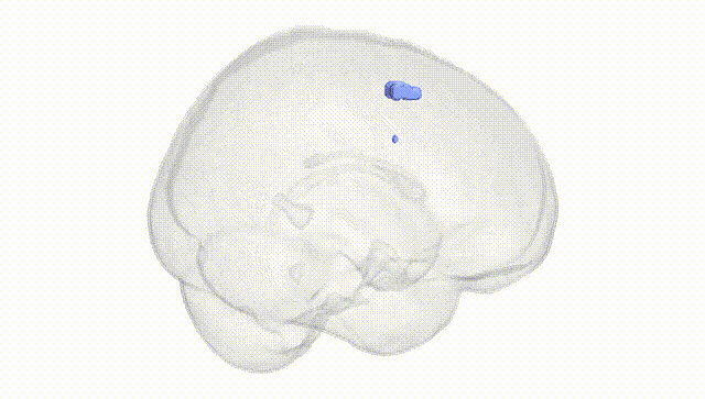 Full Brain White