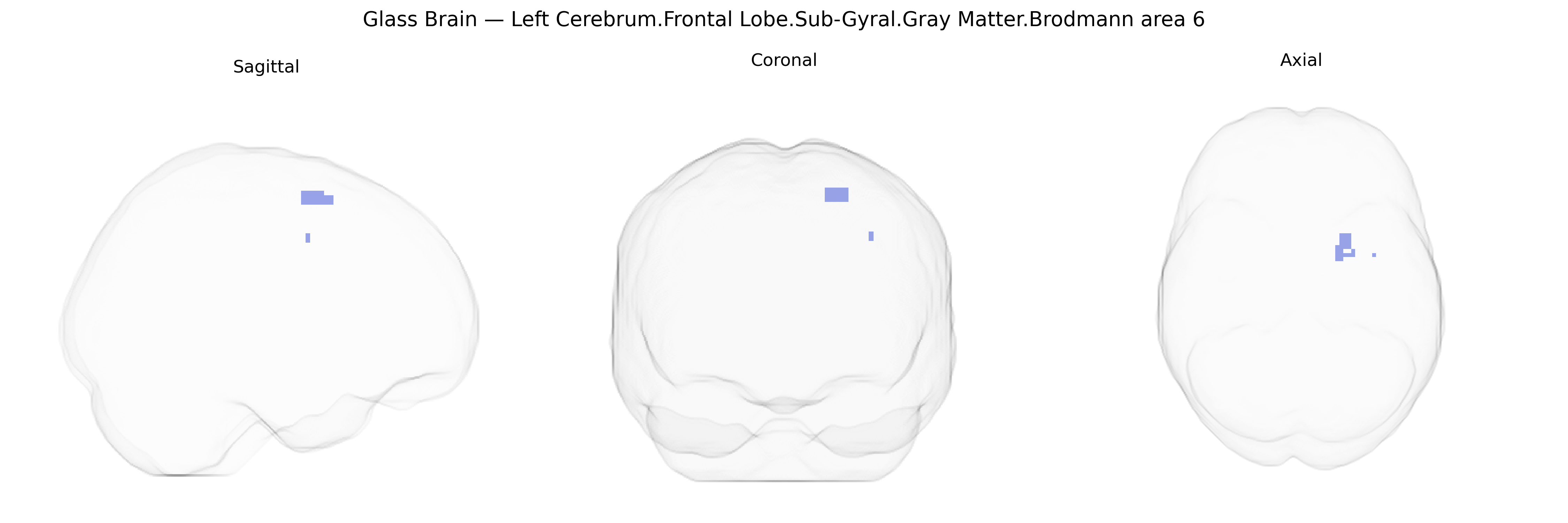 Triplanar Ghost Brain