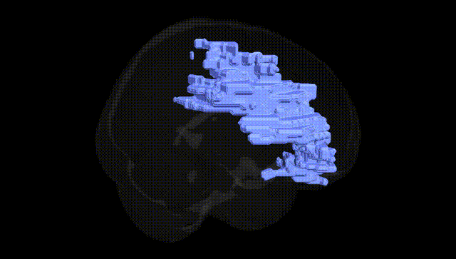 Full Brain Black