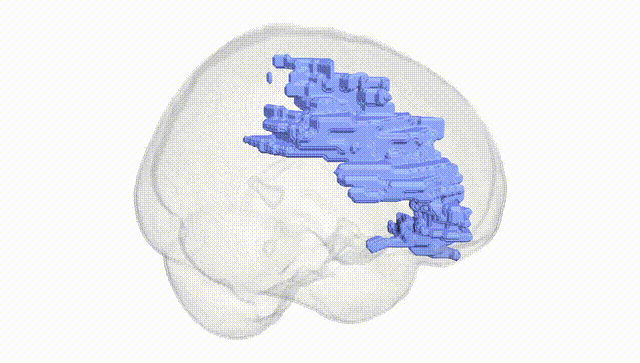 Full Brain White