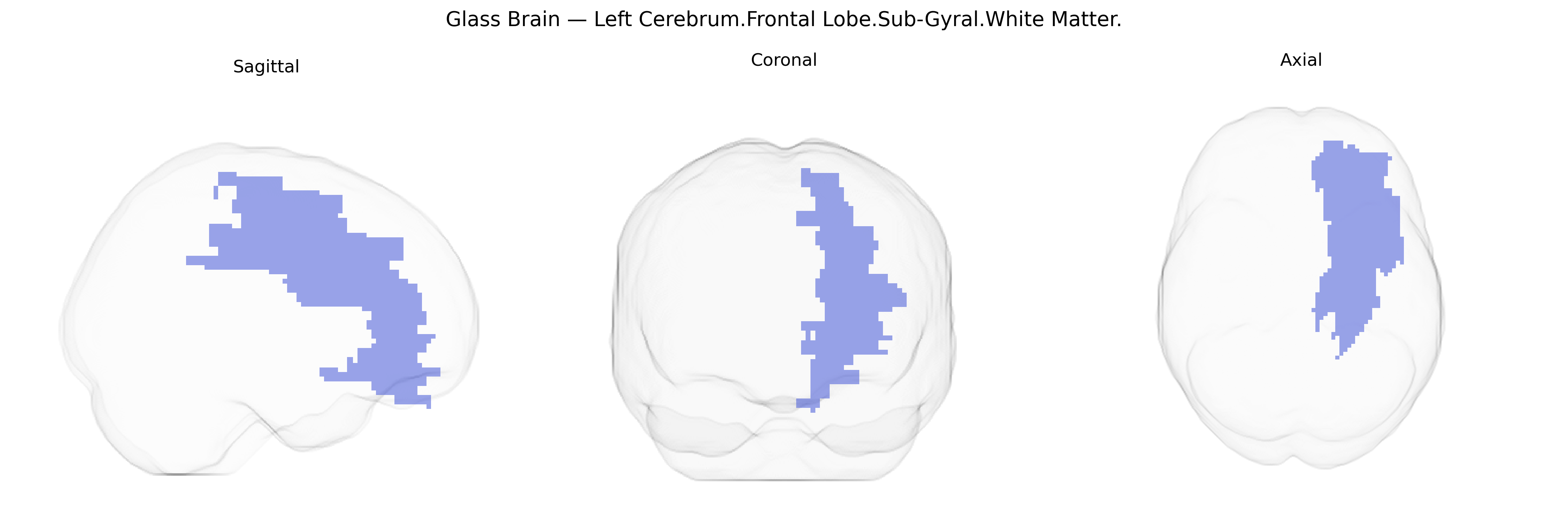 Triplanar Ghost Brain