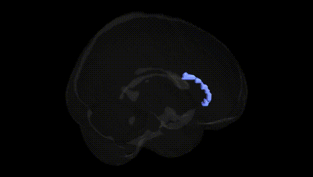 Full Brain Black